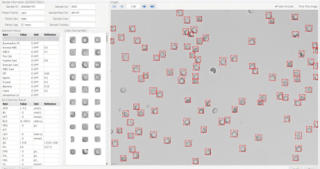 Urinalysis Hybrid Analyzer Results Resultados del analizador híbrido de análisis de orina