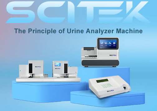 The Principle of Urine Analyzer Machine.png