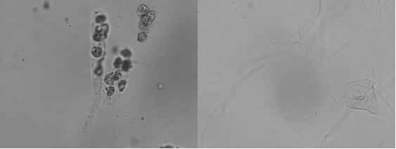 Urinalysis Hybrid Analyzer Results-1 Resultados del analizador híbrido de análisis de orina-1